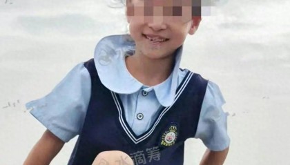 河南汝州33岁女子做饭时煤气突然爆炸，7岁女儿瞬间被火势冲到1米外，两人严重烧伤