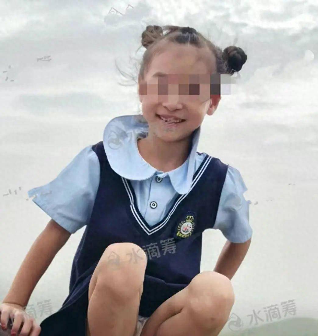 河南汝州33岁女子做饭时煤气突然爆炸，7岁女儿瞬间被火势冲到1米外，两人严重烧伤