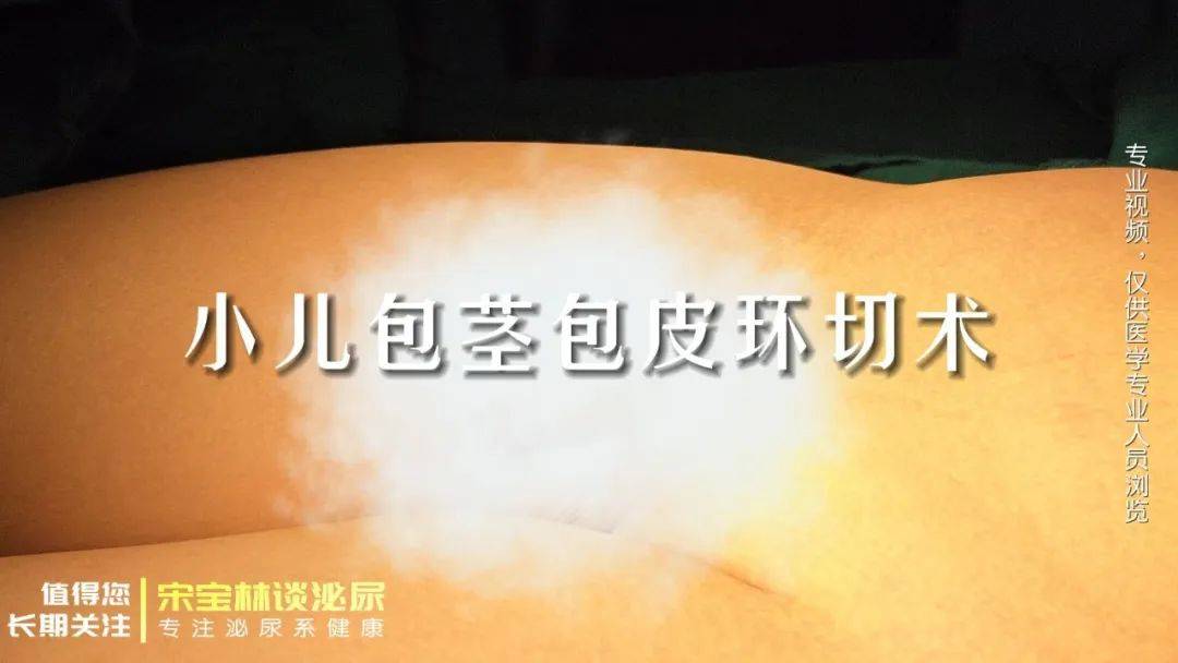 081手术视频｜小儿包茎包皮环切术（使用一次性包皮环切缝合器）
