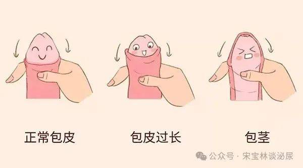 包裹与绽放：全面解读包茎与包皮过长